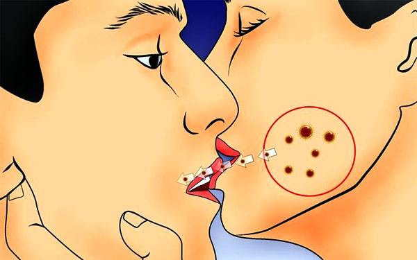 Какие болезни передаются через поцелуй